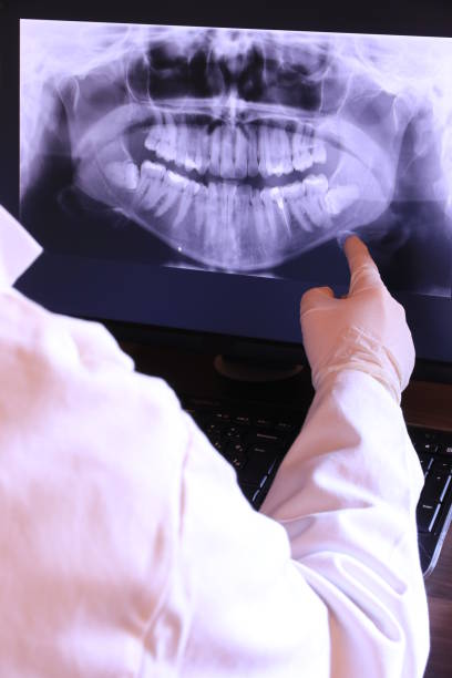 Best Emergency Treatment for Oral Infections in Deadwood, SD
